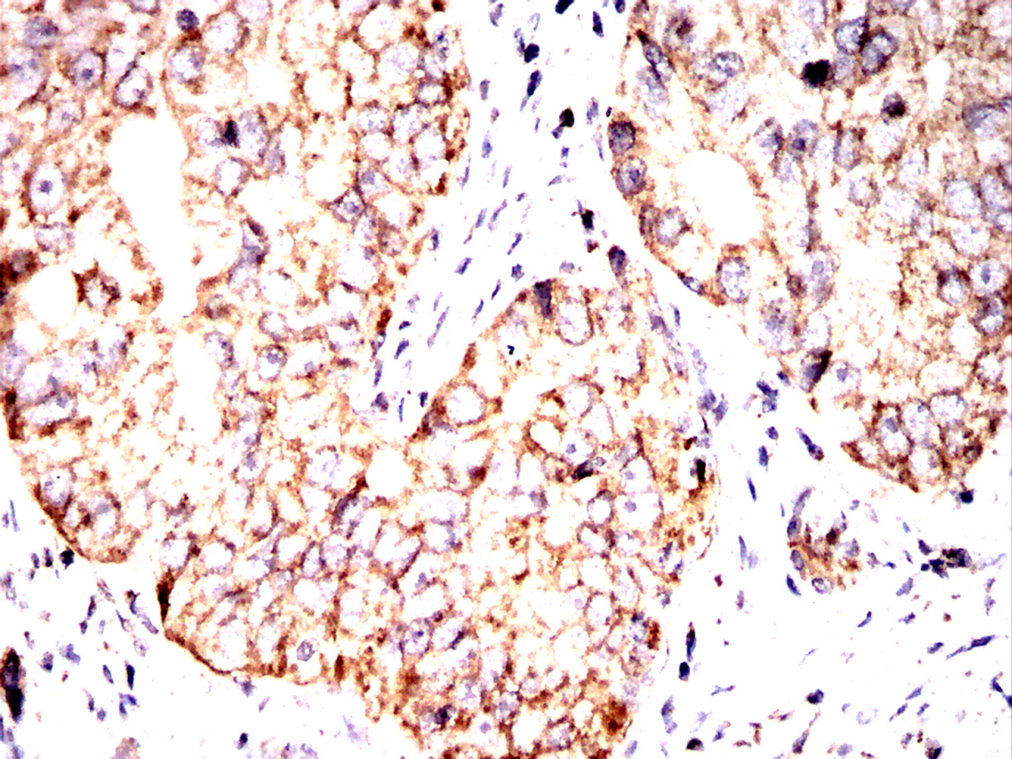 IHC